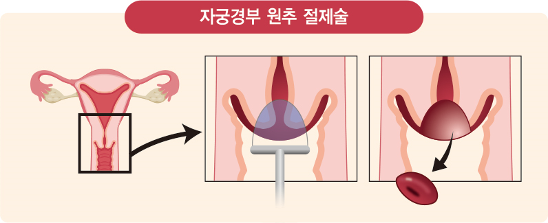(강동경희대병원)