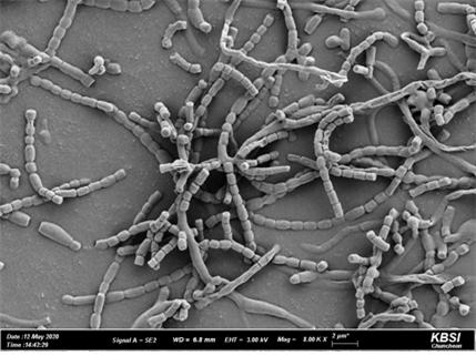 ▲균주 SJ1-7 포자의 주사전자현미경 사진. (자료제공=국립생물자원관)