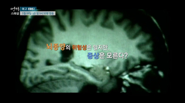▲EBS '명의 스페셜–뇌종양, 그 한계를 넘다'(사진제공=EBS1)