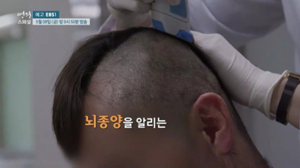 ▲EBS '명의 스페셜–뇌종양, 그 한계를 넘다'(사진제공=EBS1)