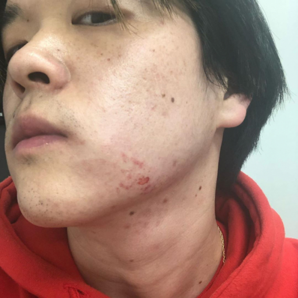 ▲킹치메인이 비프리에 폭행당한 사진을 SNS에 공개했다.(킹치메인 SNS)