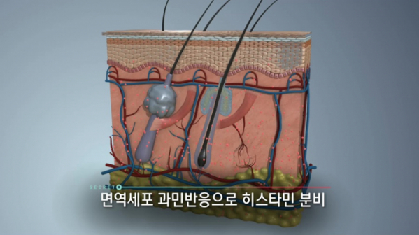 ▲'생로병사의 비밀' 알레르기(사진제공=KBS 1TV)