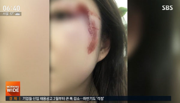 ▲서울역에서 30대 여성을 '묻지마 폭행'한 용의자가 경찰에 붙잡혔다.  (출처=SBS 뉴스 캡처)