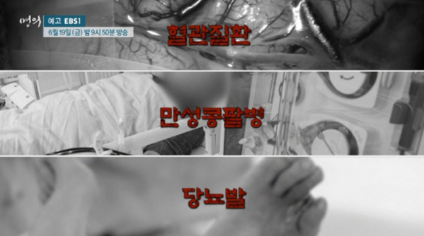 ▲EBS '명의 스페셜' 고혈압(사진제공=EBS1)