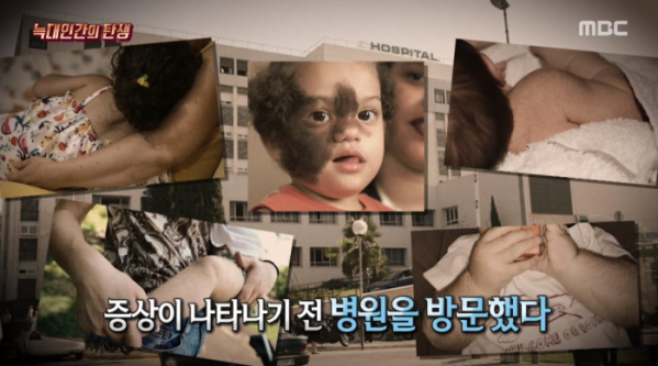 ▲스페인 늑대인간 소동(사진=MBC '서프라이즈' 방송화면 캡처)