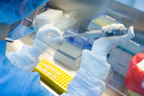 ▲러시아 상트페테르부르크에 있는 바이오캐드 연구실에서 6월 11일(현지시간) 연구원이 신종 코로나바이러스 감염증(코로나19) 백신 실험을 하고 있다. 상트페테르부르크/로이터연합뉴스
