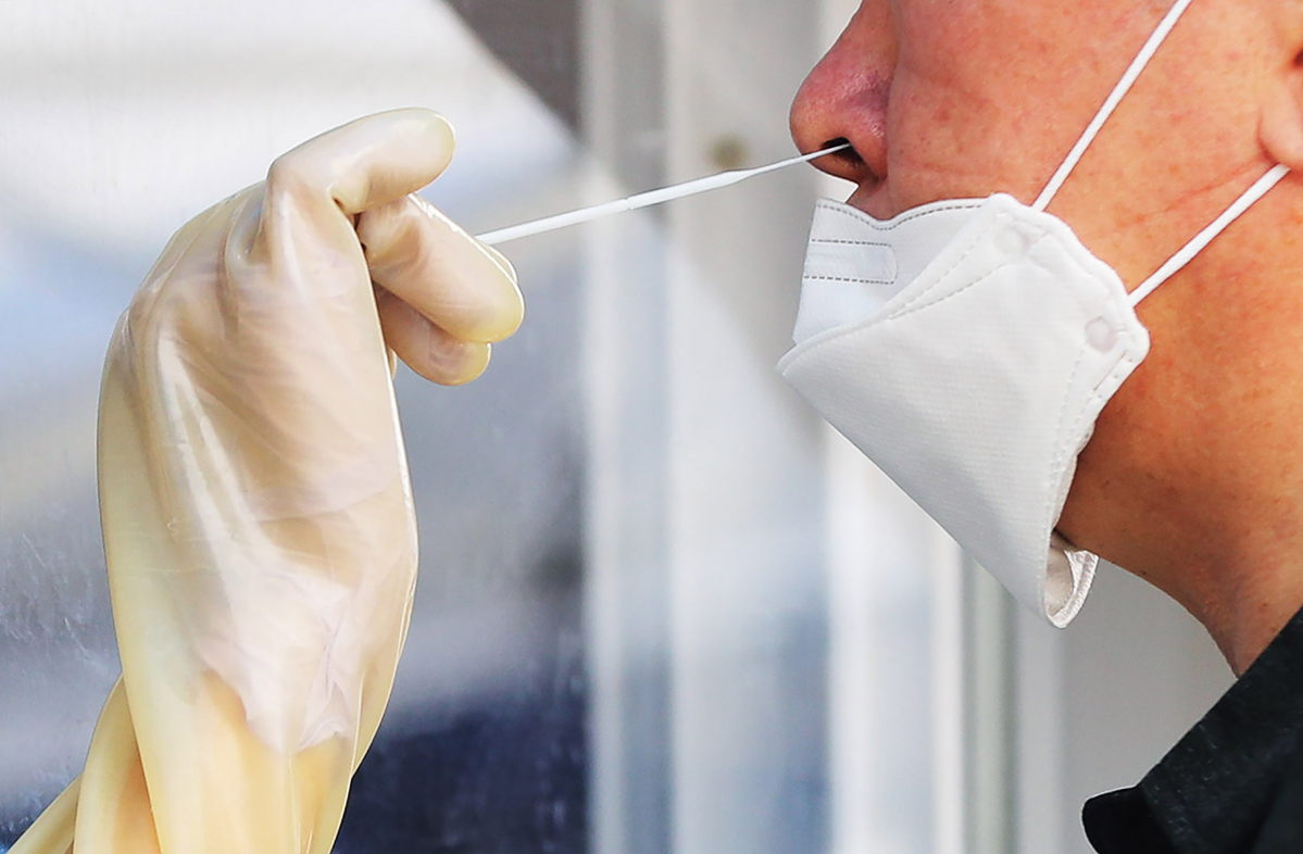 ▲코로나19 검사