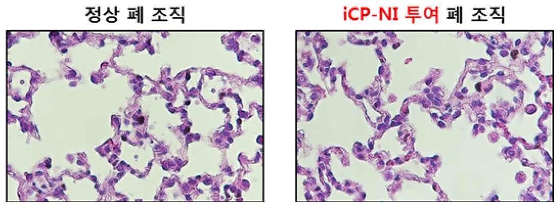▲셀리버리는 최고농도 iCP-NI를 5일간 반복 투여한 결과 정상 폐 조직과 차이가 없는 것으로 나타났다고 설명했다. (자료제공=셀리버리)