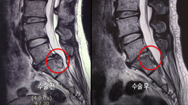 ▲'생로병사의 비밀'(사진제공=KBS 1TV)