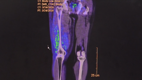 ▲'생로병사의 비밀'(사진제공=KBS 1TV)