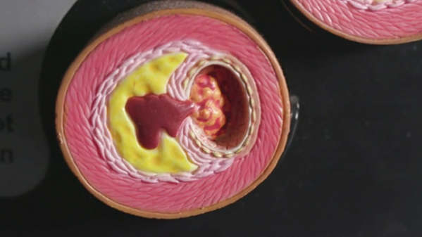 ▲EBS '명의'(사진제공=EBS1)