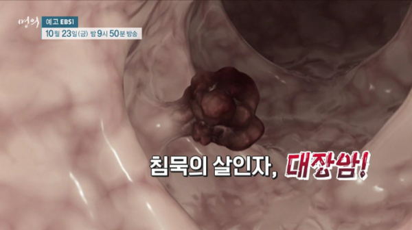 ▲EBS '명의' 김희철 교수(사진제공=EBS1)