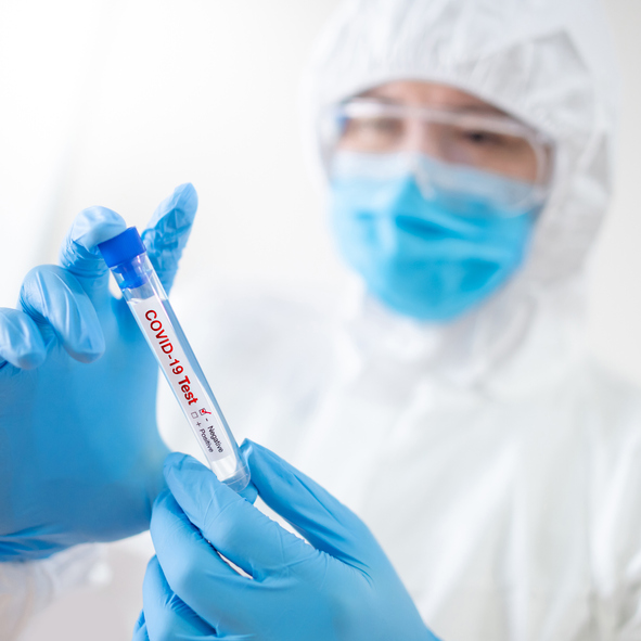 ▲Medical scientist man in biohazard chemical protective suit (PPE), mask and goggles holding COVID-19 Test tube in hospital laboratory. Male doctor or physician getting result of Coronavirus case.