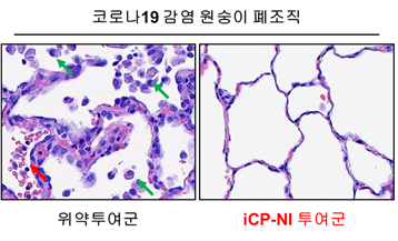 ▲코로나19 감염 원숭이의 폐 조직파괴 치료효능. 위약투여군에서 면역세포 침윤 (녹색 화살표)과 출혈 (붉은색 화살표)이 보이는 것과 달리, iCP-NI 투여군에서는 조직파괴가 발견되지 않았다. (자료제공=셀리버리)