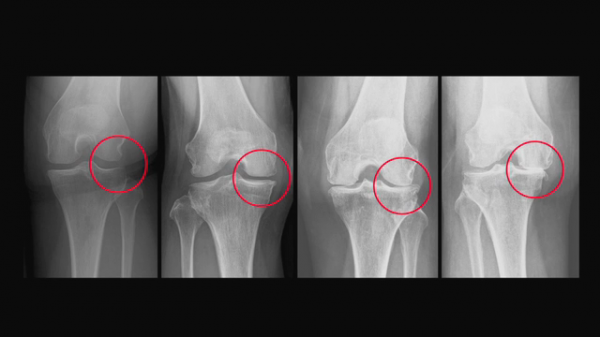 ▲EBS '명의' (사진제공=EBS1)