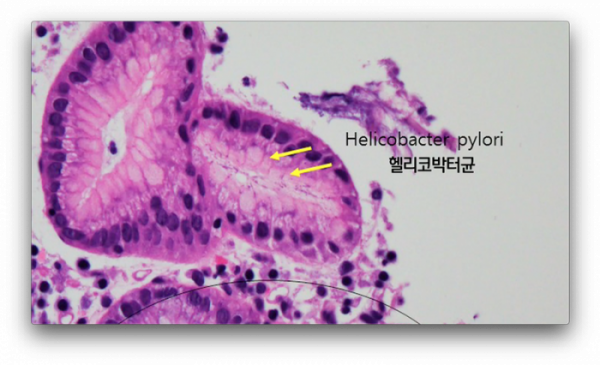 ▲'생로병사의 비밀'(사진제공=KBS 1TV)