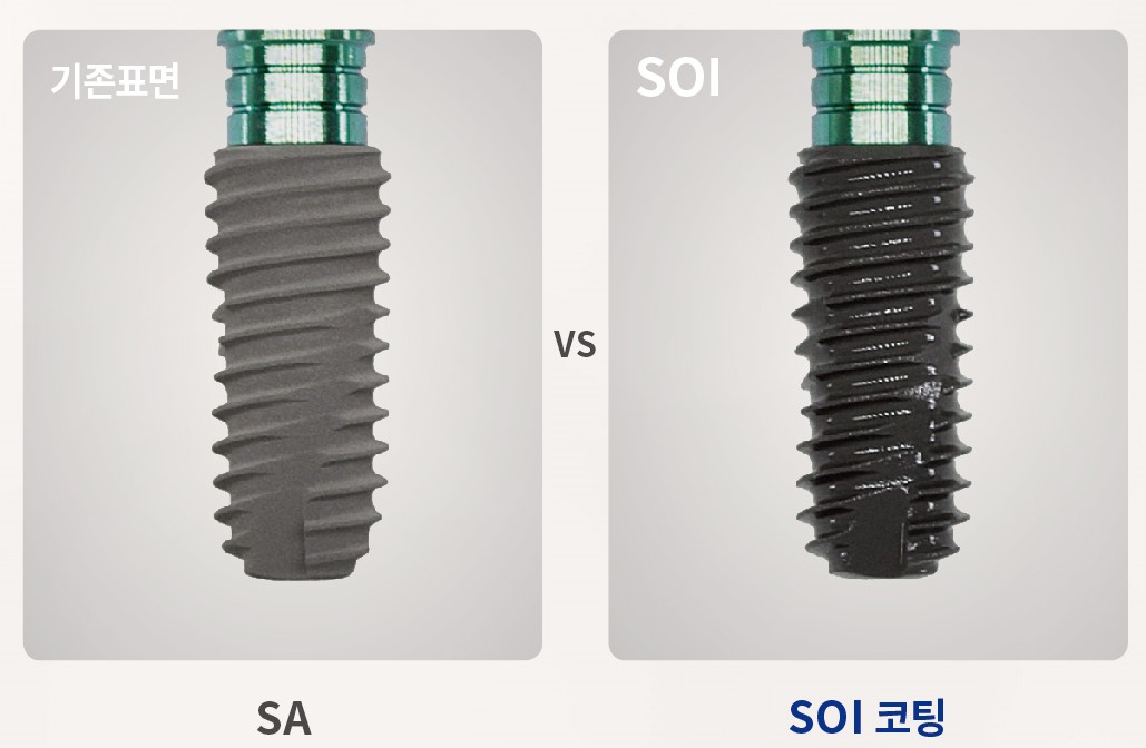 ▲오스템임플란트의 SOI 이미지.  (사진제공=오스템임플란트)