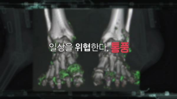 ▲'명의'(사진제공=EBS1)