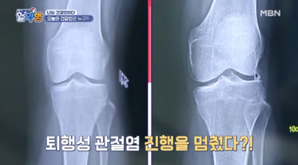 ▲'알약방'(사진제공=MBN)