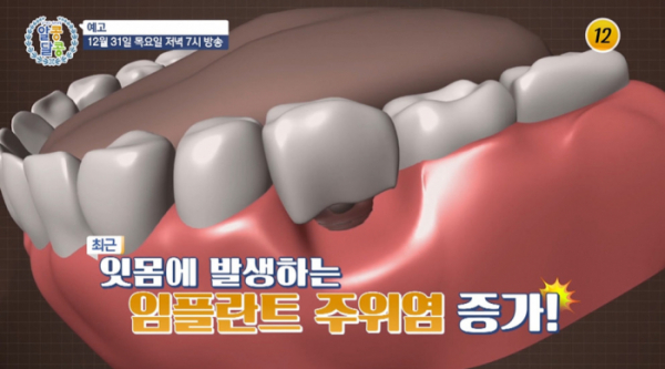 ▲'알콩달콩' 김지현(사진제공=TV조선)