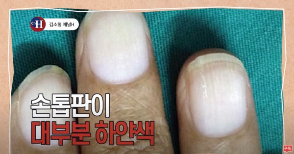 (사진출처=유튜브 <김소형 채널H>)
