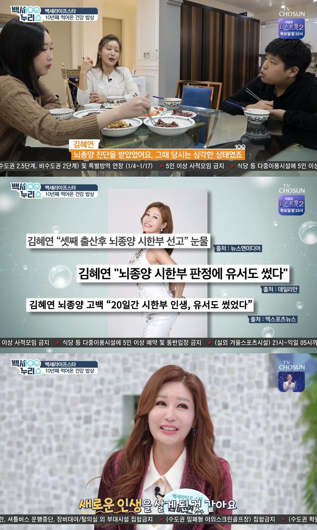 ▲김혜연 (출처=TV조선 '백세누리쇼' 방송캡처)