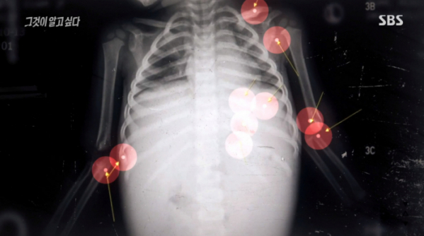 ▲'그알'(사진제공=SBS)