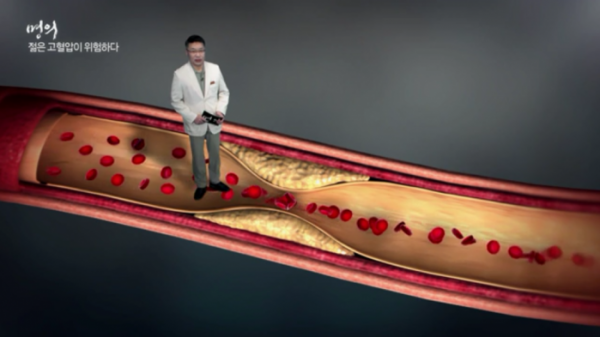 ▲'명의' 고혈압(사진제공=EBS1)