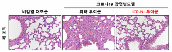 ▲생물무기로 사용되는 슈퍼항원 접종으로 유도된 코로나19 감염병 폐조직 손상모델은 산소교환을 위한 폐 다공성 구조와 기능을 상실(가운데)했으나, iCP-NI 투여군(오른쪽)의 폐 조직은 비감염 대조군(왼쪽)과 동일하게 폐조직 파괴가 없는 것으로 나타났다. (자료제공=셀리버리)