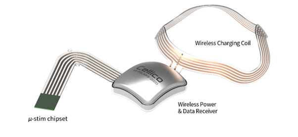 ▲셀리코 전자눈 (사진제공= 셀리코)