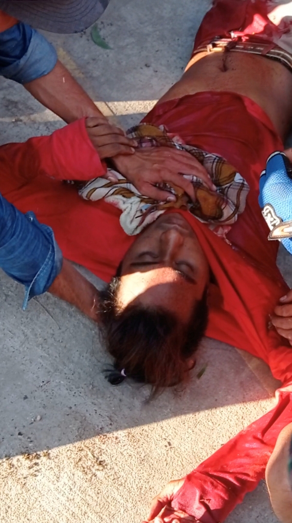 ▲3일 미얀마 노스 오칼라파에서 시위 중이던 한 남성이 쓰러진 채 치료를 받고 있다. 노스 오칼라파/로이터연합뉴스
