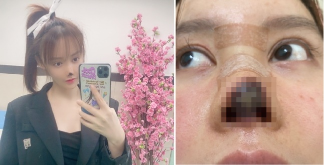 (출처=가오 리우 SNS)