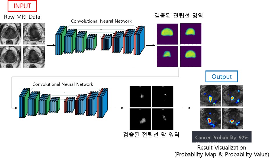 ▲제이엘케이 JPC-01K의 이미지 (사진제공=제이엘케이)