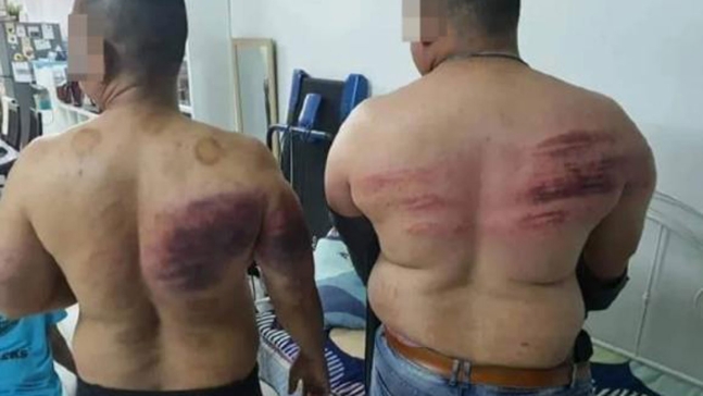 ▲말레이 고용주에 폭행당한 경호원들 (사진제공=하리안메트로)