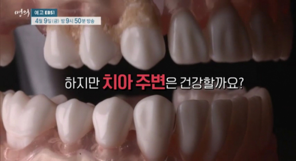 ▲'명의'(사진제공=EBS1)