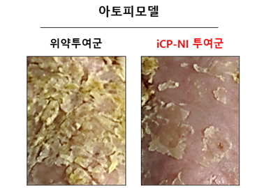 ▲아토피피부염 동물모델에서 연고제형 iCP-NI의 치료효능 (사진제공=셀리버리)