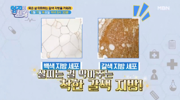 ▲'엄지의 제왕'(사진제공=MBN)