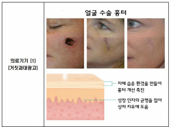 ▲주요 위반 사례 (사진제공=식약처)