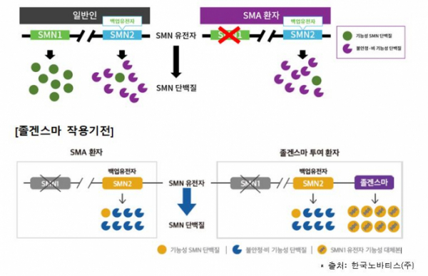 ▲일반인과 척수성 근위축증(SMA) 환자의 차이 (사진제공=식약처)