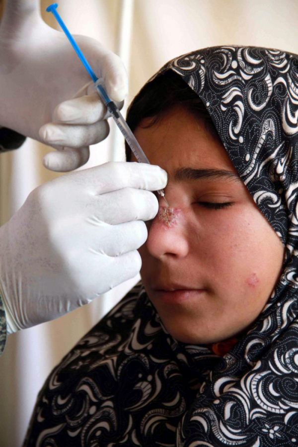 ▲2010년 10월 30일 아프가니스탄 서부 히라트에서 한 아프가니스탄 소녀가 리슈마니아 치료 주사를 맞고 있다.  (EPA/연합뉴스)