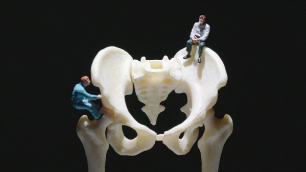 ▲'명의' 류마티스 관절염(사진제공=EBS1)
