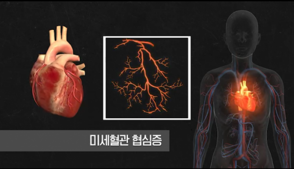 ▲'생로병사의 비밀'(사진제공=KBS 1TV)