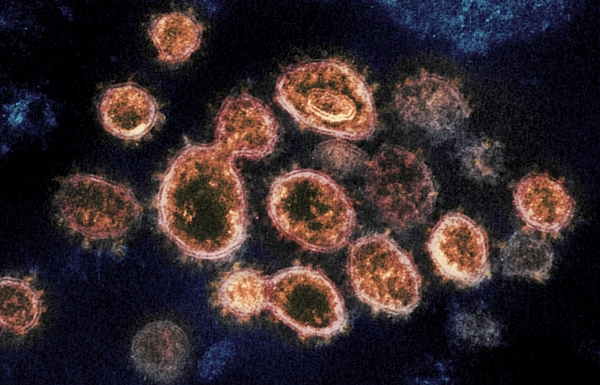 ▲미국 국립 알레르기·전염병 연구소(NIAID)가 공개한 신종 코로나바이러스 감염증(코로나19)를 유발하는 바이러스(SARS-CoV-2) 입자 전자현미경 이미지. AP뉴시스
