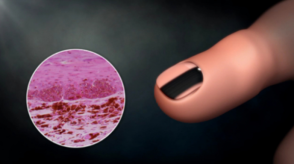 ▲'명의'(사진제공=EBS1)