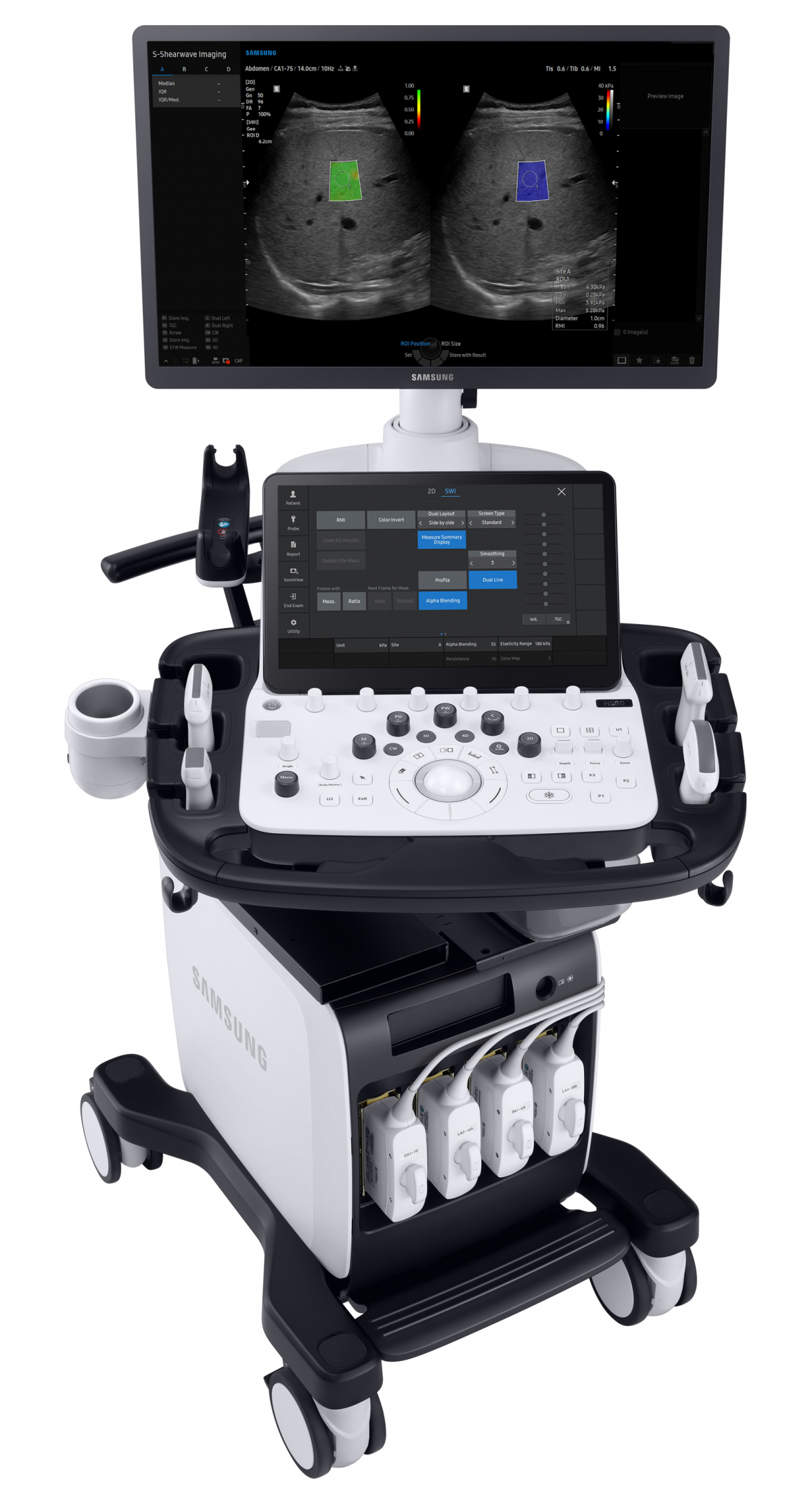 ▲간조직의 탄성도를 확인할 수 있는 '에스 쉬어웨이브 이미징(S-Shearwave Imaging)' 기능이 탑재된 고급형 초음파 진단기기(V8) (사진제공=삼성메디슨)