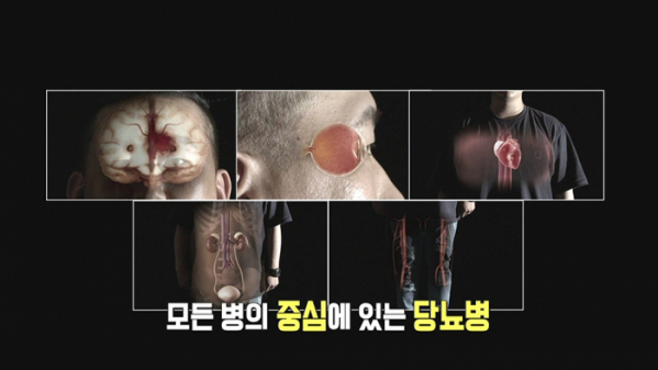 ▲'명의' 당뇨병(사진제공=EBS1)