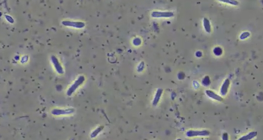 ▲'다큐프라임'(사진제공=MBC)