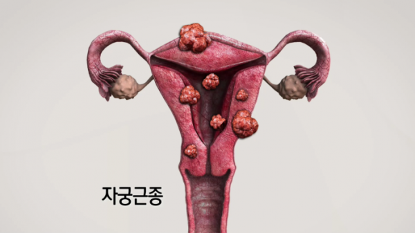 ▲'생로병사의 비밀'(사진제공=KBS 1TV)