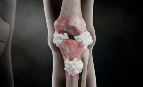 ▲'명의'(사진제공=EBS1)