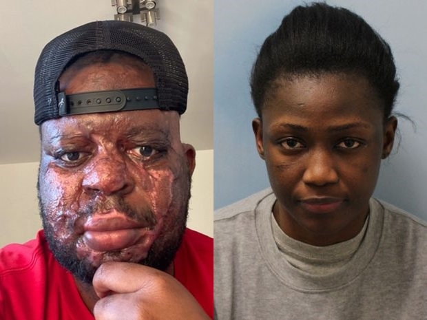 ▲황산 테러를 당한 켈빈 포고(왼)와 범행을 저지른 에스더 아프리파. (출처=미러 갈무리)